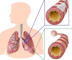 Image for the left image of the connect pair